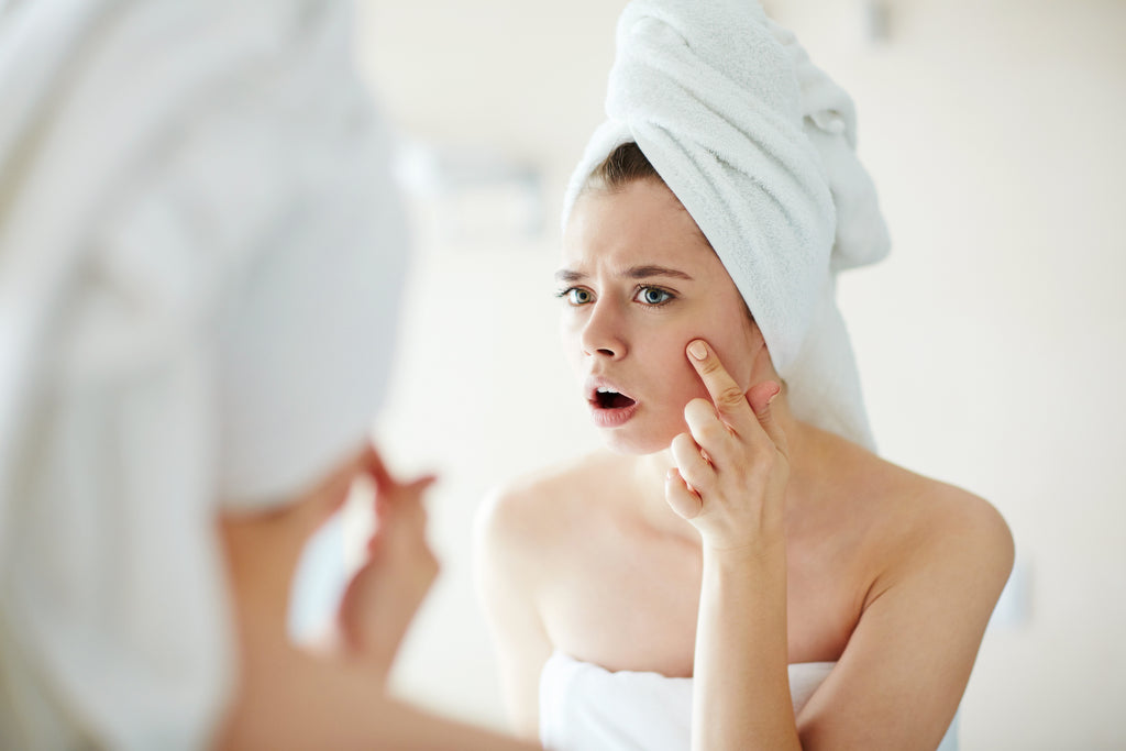 Your Pillowcase Might Be Causing Your Breakouts
